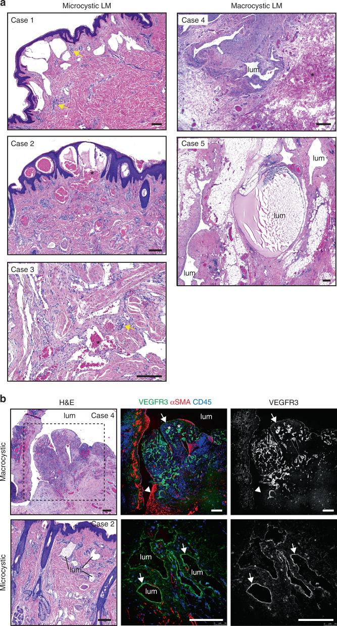 https://cdn.ncbi.nlm.nih.gov/pmc/blobs/e573/7280302/9ddb9ddd9989/41467_2020_16496_Fig1_HTML.jpg