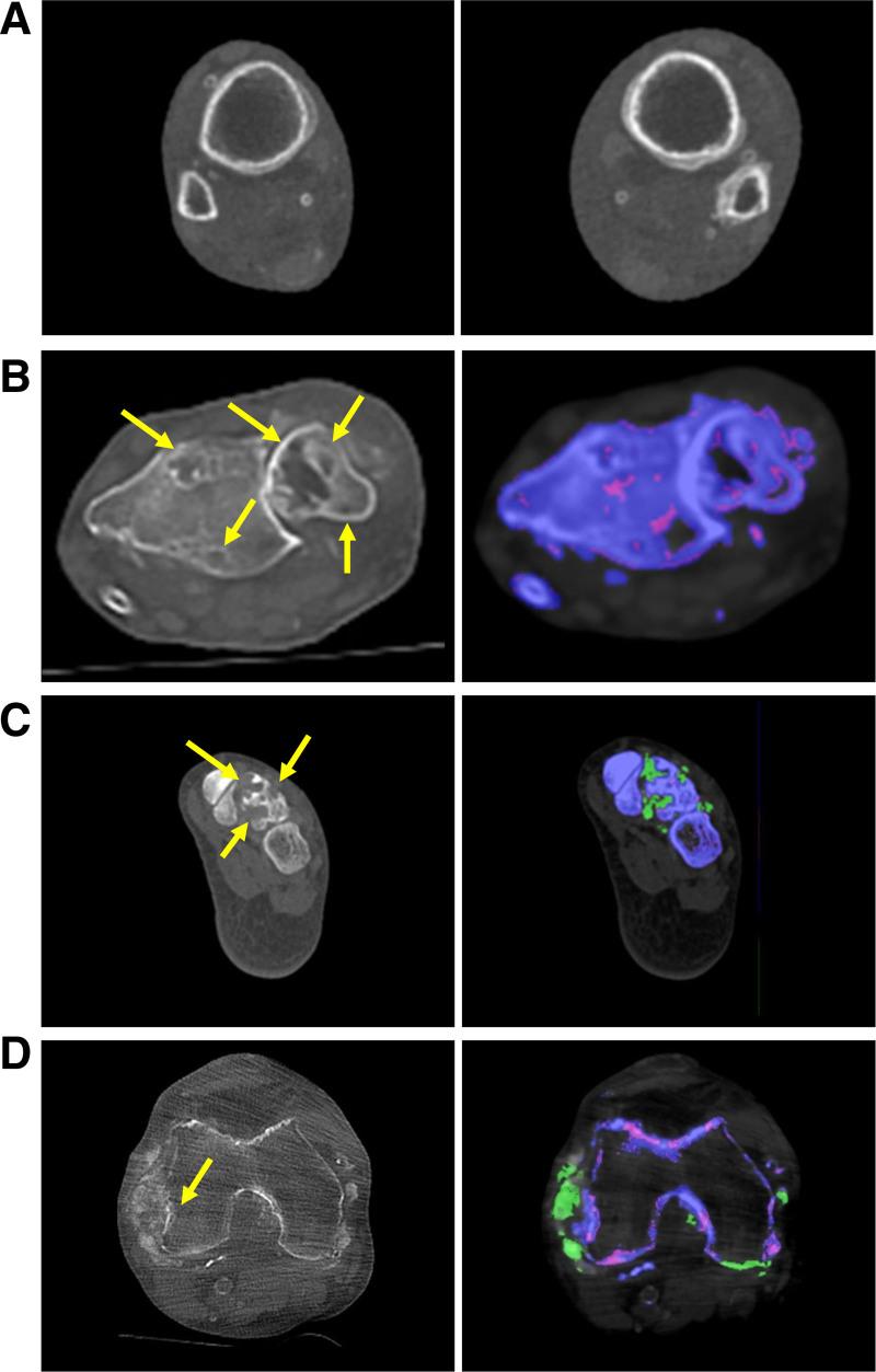 https://cdn.ncbi.nlm.nih.gov/pmc/blobs/e576/12074116/1c3e26553e2a/txd-11-e1803-g002.jpg