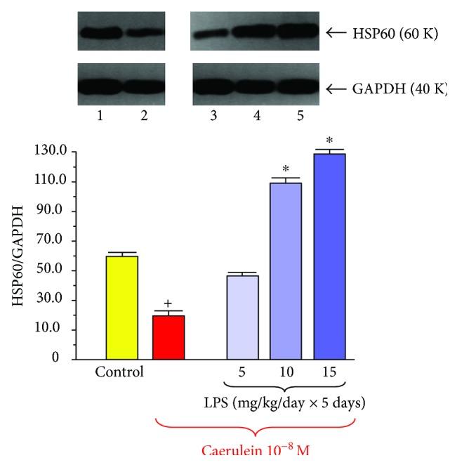 https://cdn.ncbi.nlm.nih.gov/pmc/blobs/e57a/5821989/ca2c6b6e8c82/GRP2018-6915059.008.jpg
