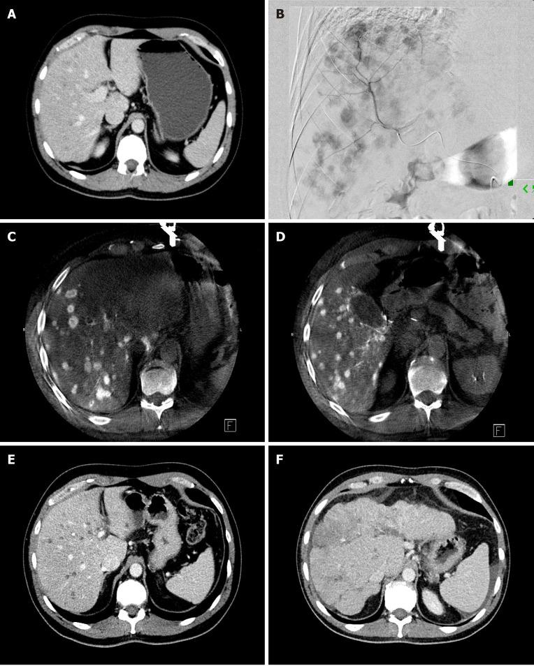 https://cdn.ncbi.nlm.nih.gov/pmc/blobs/e57a/8316906/fd310af10120/WJG-27-4322-g004.jpg