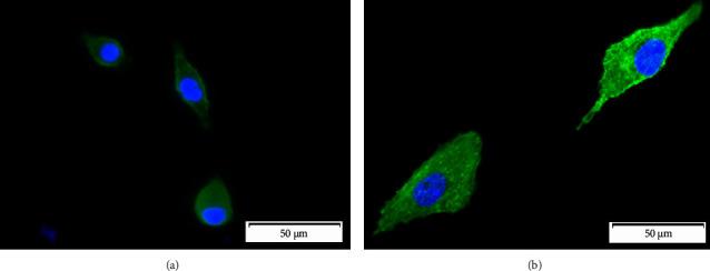 https://cdn.ncbi.nlm.nih.gov/pmc/blobs/e585/10907100/6ac9dce6bd03/IJBM2024-5102603.006.jpg