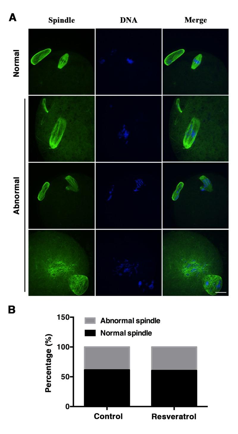 https://cdn.ncbi.nlm.nih.gov/pmc/blobs/e585/6075442/b66bd3585247/aging-10-101494-g006.jpg