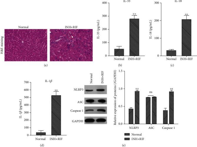 https://cdn.ncbi.nlm.nih.gov/pmc/blobs/e586/7914095/8db138b6df18/MI2021-8086253.001.jpg