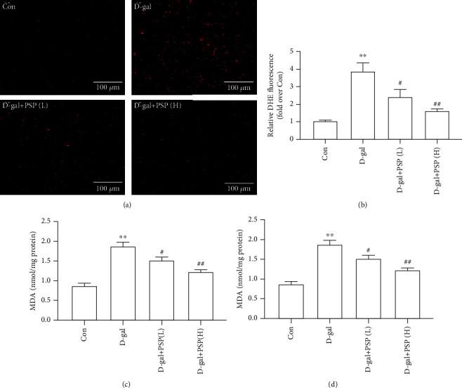 https://cdn.ncbi.nlm.nih.gov/pmc/blobs/e591/8024086/85eb029c6ea0/BMRI2021-6688855.003.jpg