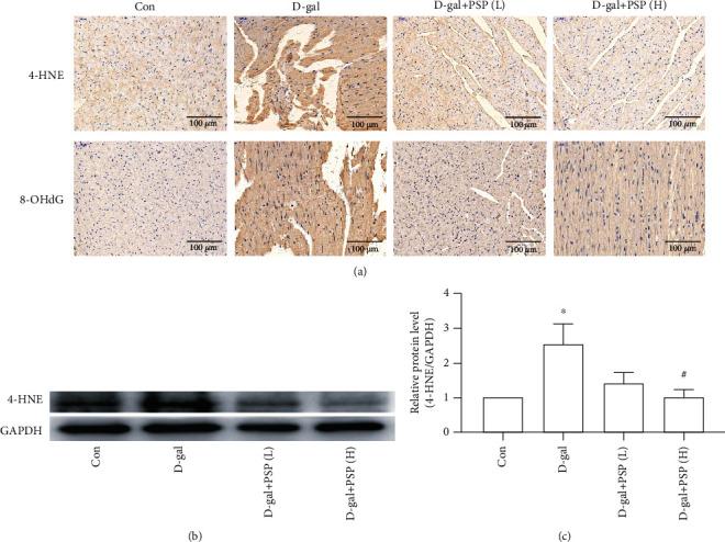 https://cdn.ncbi.nlm.nih.gov/pmc/blobs/e591/8024086/bd5a178c96ae/BMRI2021-6688855.004.jpg