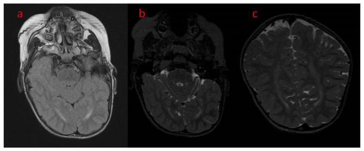 https://cdn.ncbi.nlm.nih.gov/pmc/blobs/e596/9776588/c0d95fbbda75/children-09-01806-g002.jpg