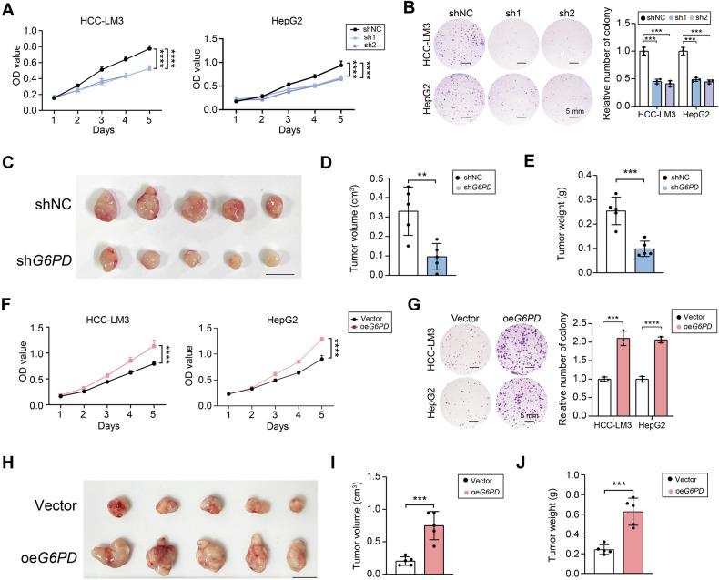 https://cdn.ncbi.nlm.nih.gov/pmc/blobs/e597/12277399/e04f0790b458/41419_2025_7842_Fig4_HTML.jpg