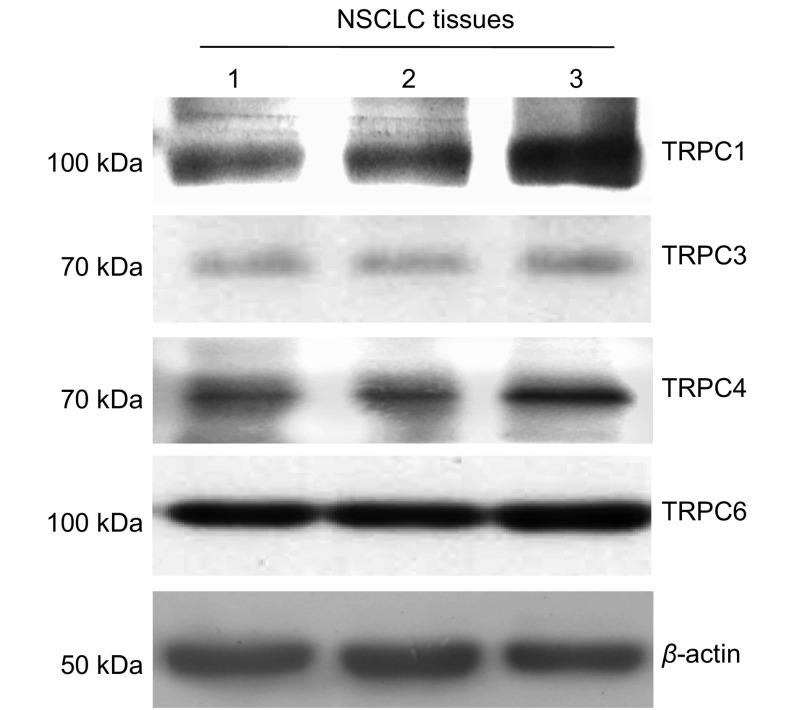 https://cdn.ncbi.nlm.nih.gov/pmc/blobs/e59a/6015152/eb46ecdf2fe6/zgfazz-13-6-612-3.jpg