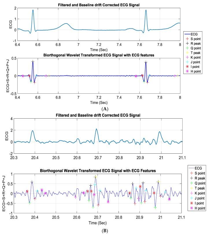 https://cdn.ncbi.nlm.nih.gov/pmc/blobs/e5a1/6632021/4b16b3564ac5/sensors-19-02780-g014.jpg