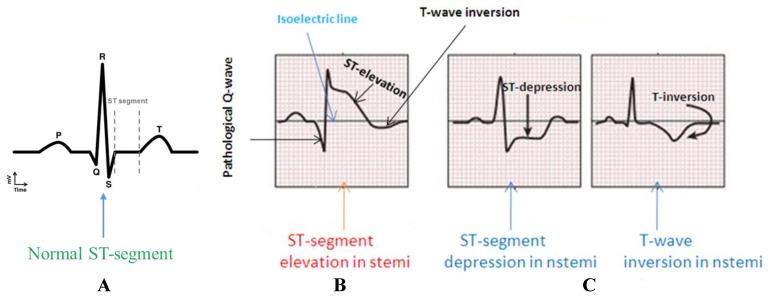 https://cdn.ncbi.nlm.nih.gov/pmc/blobs/e5a1/6632021/fb983b8db544/sensors-19-02780-g001.jpg
