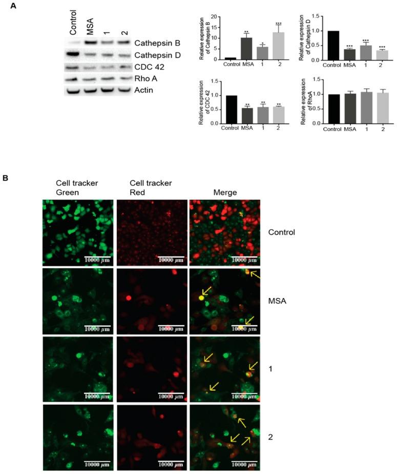 https://cdn.ncbi.nlm.nih.gov/pmc/blobs/e5a3/6213452/a32ad7f927e4/ijms-19-02849-g004.jpg