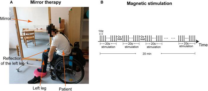 https://cdn.ncbi.nlm.nih.gov/pmc/blobs/e5a7/10251437/98c5b3790d8b/fnins-17-1187486-g0003.jpg