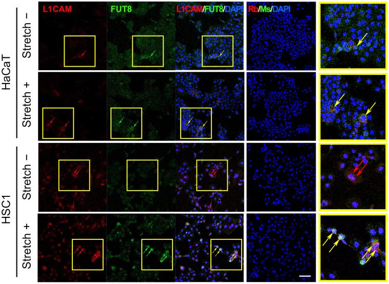 https://cdn.ncbi.nlm.nih.gov/pmc/blobs/e5aa/11843287/bd803d40f3fa/jiao-21-1-241652_f002.jpg