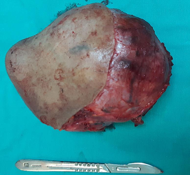 https://cdn.ncbi.nlm.nih.gov/pmc/blobs/e5ac/7501749/7b1a8537982b/PAMJ-37-2-g004.jpg