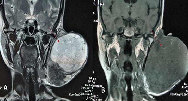 https://cdn.ncbi.nlm.nih.gov/pmc/blobs/e5ac/7501749/c463d9b6819f/PAMJ-37-2-g002.jpg