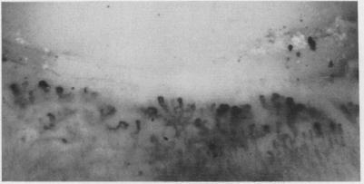 https://cdn.ncbi.nlm.nih.gov/pmc/blobs/e5ad/1001718/7f731aef4913/annrheumd00264-0031-a.jpg
