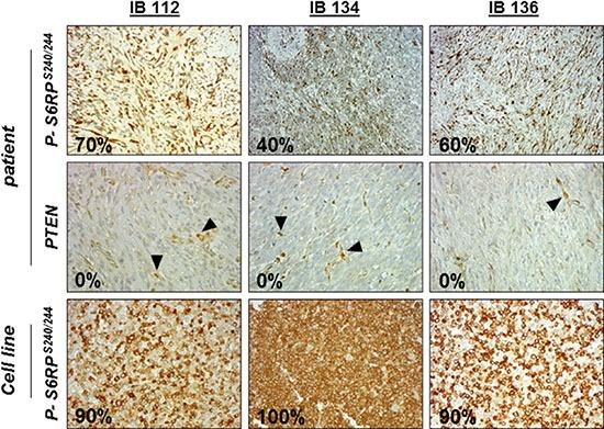 https://cdn.ncbi.nlm.nih.gov/pmc/blobs/e5ad/5352367/4e9f6e67c0ea/oncotarget-08-7878-g001.jpg