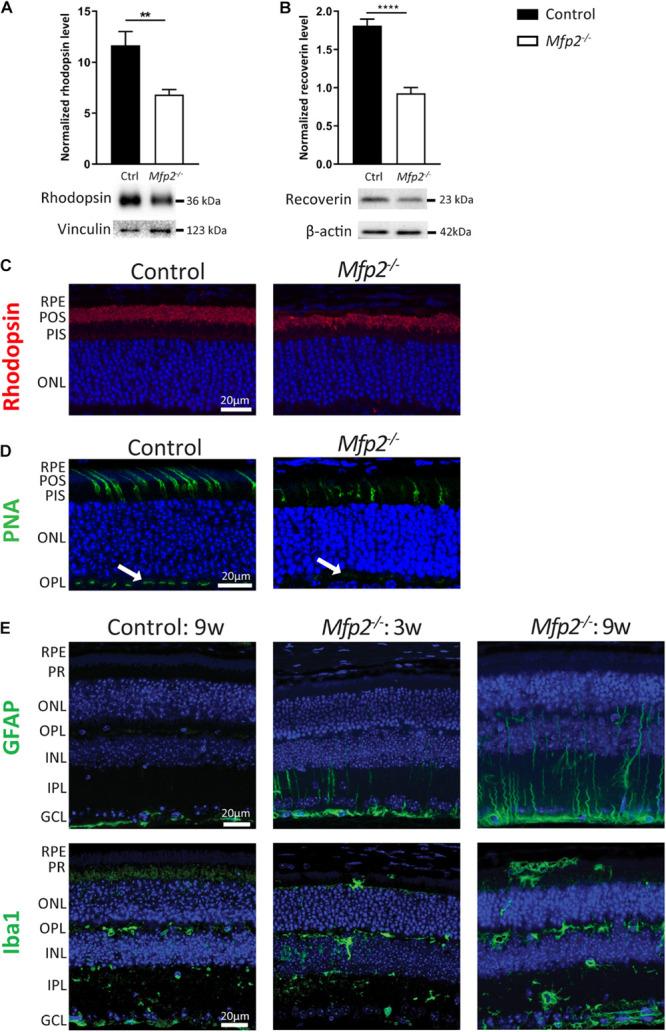 https://cdn.ncbi.nlm.nih.gov/pmc/blobs/e5b3/7884615/e98554921ddc/fcell-09-632930-g006.jpg