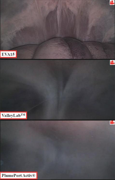 https://cdn.ncbi.nlm.nih.gov/pmc/blobs/e5b5/12054670/c2d5b442c610/MGR-15-404-g003.jpg