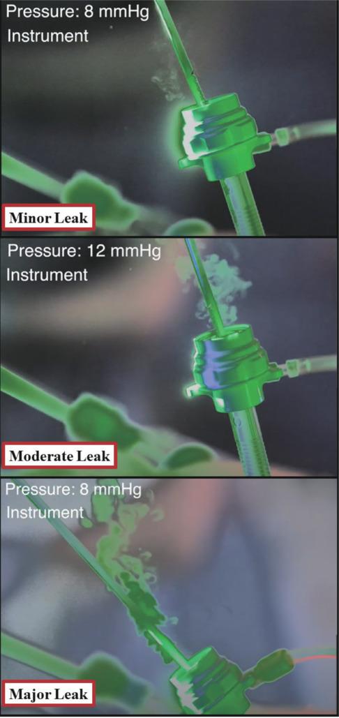 https://cdn.ncbi.nlm.nih.gov/pmc/blobs/e5b5/12054670/d3ad7e8c83be/MGR-15-404-g004.jpg