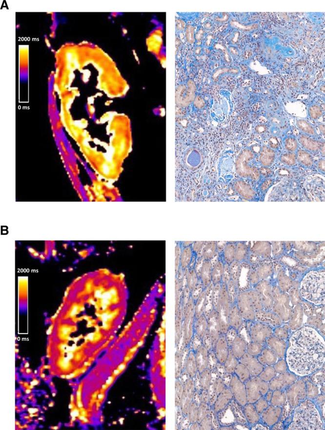 https://cdn.ncbi.nlm.nih.gov/pmc/blobs/e5b8/7581173/b819baf94309/txd-6-e577-g004.jpg