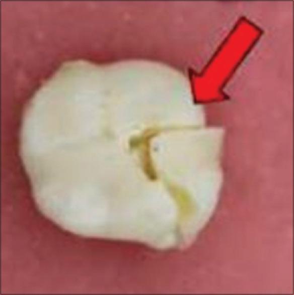 https://cdn.ncbi.nlm.nih.gov/pmc/blobs/e5b9/8686919/96c565be6d58/JPBS-13-1597-g006.jpg