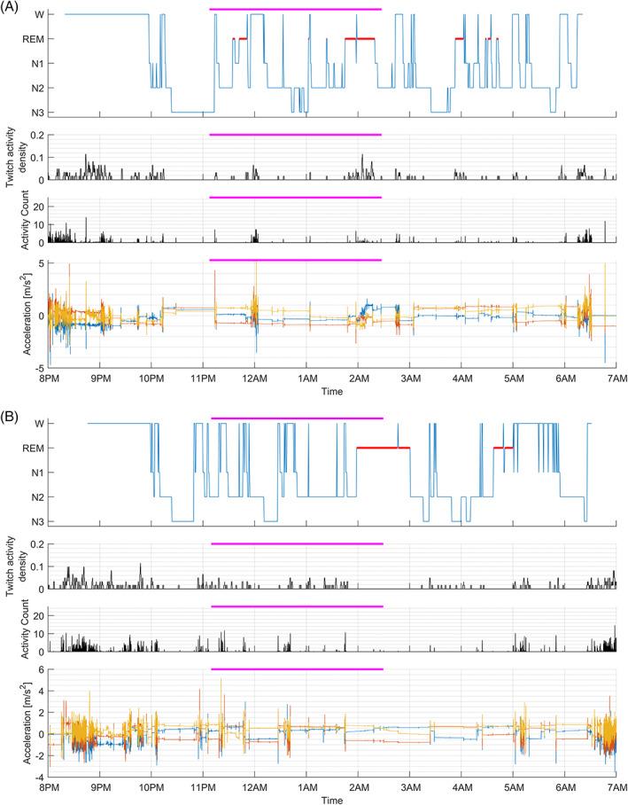 https://cdn.ncbi.nlm.nih.gov/pmc/blobs/e5cb/10092688/54d1dbc8c352/MDS-38-82-g003.jpg