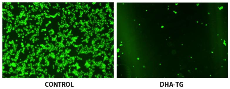 https://cdn.ncbi.nlm.nih.gov/pmc/blobs/e5d2/8000043/8b504594a353/antioxidants-10-00386-g002.jpg