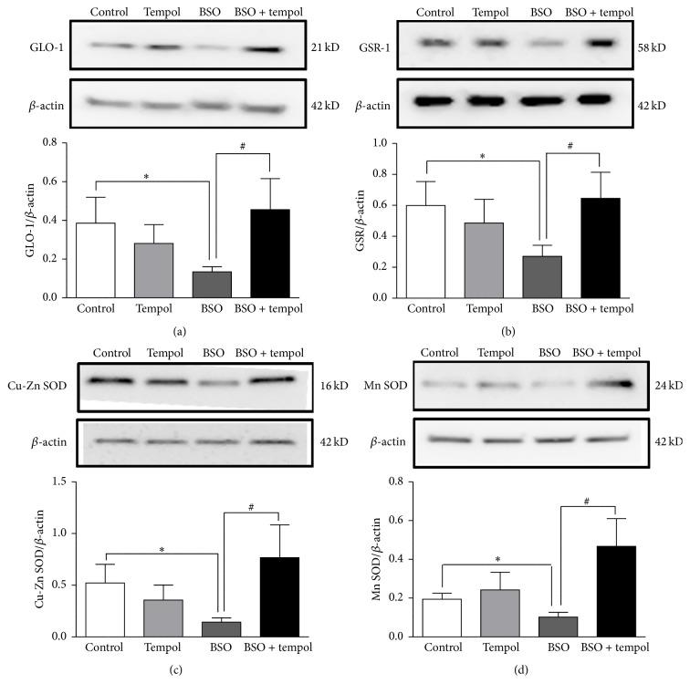 https://cdn.ncbi.nlm.nih.gov/pmc/blobs/e5d9/4812466/71454517e709/OMCL2016-5059043.002.jpg