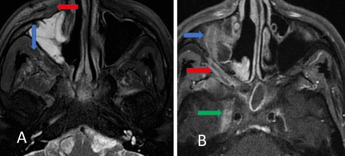 https://cdn.ncbi.nlm.nih.gov/pmc/blobs/e5d9/9540166/e4a19168a031/11046_2022_670_Fig1_HTML.jpg