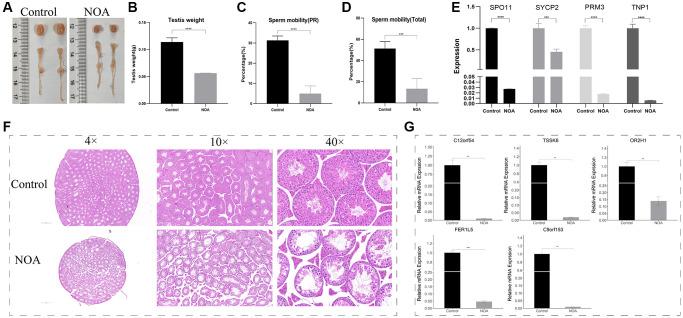 https://cdn.ncbi.nlm.nih.gov/pmc/blobs/e5db/10257997/38d0b61e8177/aging-15-204749-g007.jpg