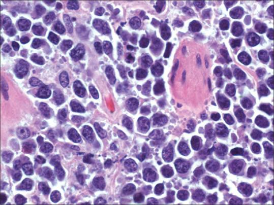https://cdn.ncbi.nlm.nih.gov/pmc/blobs/e5db/7875035/352156802ac7/WJNM-19-428-g005.jpg