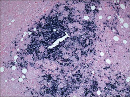 https://cdn.ncbi.nlm.nih.gov/pmc/blobs/e5db/7875035/73efce852602/WJNM-19-428-g006.jpg