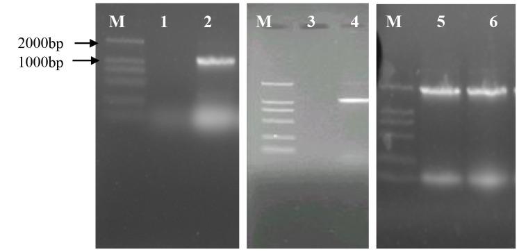 https://cdn.ncbi.nlm.nih.gov/pmc/blobs/e5dc/4182472/ec8a6df509b0/pone.0108311.g006.jpg