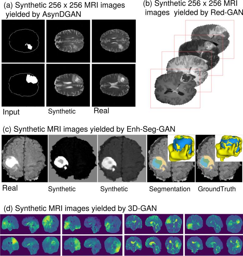 https://cdn.ncbi.nlm.nih.gov/pmc/blobs/e5df/9742072/8e6dea5efb4d/13244_2022_1315_Fig9_HTML.jpg