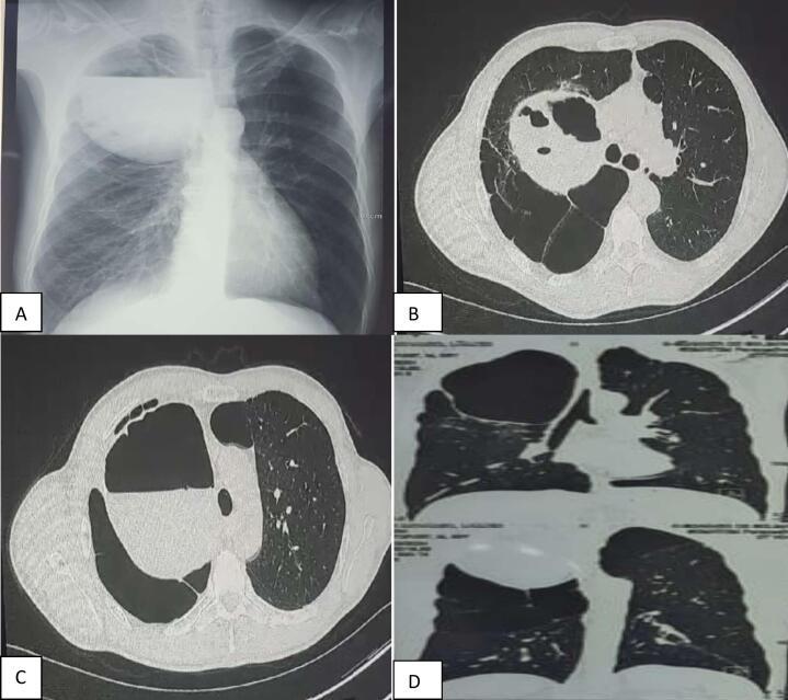 https://cdn.ncbi.nlm.nih.gov/pmc/blobs/e5e1/11714689/37963de1c465/gr1.jpg