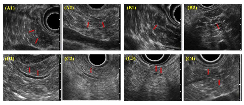 https://cdn.ncbi.nlm.nih.gov/pmc/blobs/e5e2/8000630/6a70ed74f62c/diagnostics-11-00431-g003.jpg