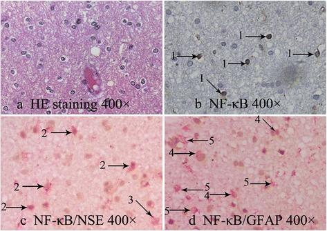 https://cdn.ncbi.nlm.nih.gov/pmc/blobs/e5e7/4365516/51367ea2a8b2/12974_2015_277_Fig1_HTML.jpg