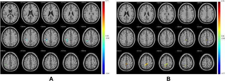 https://cdn.ncbi.nlm.nih.gov/pmc/blobs/e5f0/8703225/0ef34bc870f2/NDT-17-3753-g0008.jpg