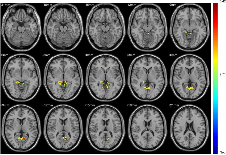 https://cdn.ncbi.nlm.nih.gov/pmc/blobs/e5f0/8703225/7dd34d0685f9/NDT-17-3753-g0002.jpg