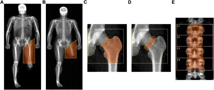 https://cdn.ncbi.nlm.nih.gov/pmc/blobs/e5f0/9634735/df82e91475a9/fphys-13-934622-g001.jpg