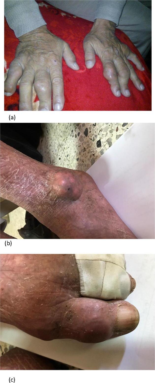 https://cdn.ncbi.nlm.nih.gov/pmc/blobs/e5f1/5512152/4e183cbe67f3/gr4.jpg