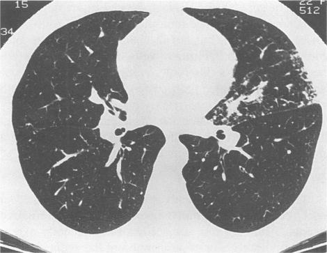 https://cdn.ncbi.nlm.nih.gov/pmc/blobs/e5f4/1022830/637494114067/westjmed00058-0037-a.jpg