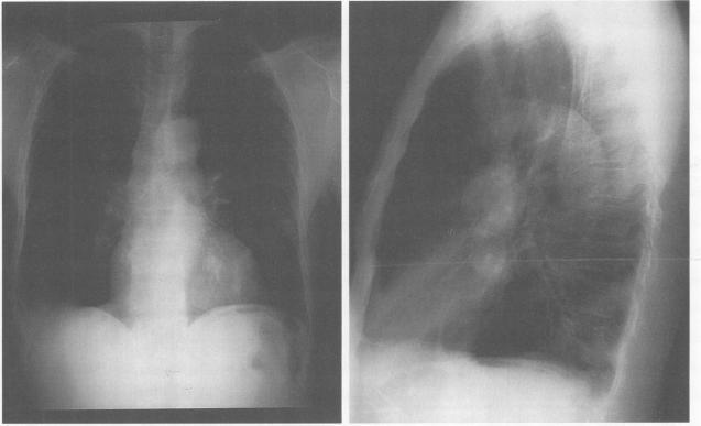 https://cdn.ncbi.nlm.nih.gov/pmc/blobs/e5f4/1022830/944e99787fa9/westjmed00058-0035-a.jpg