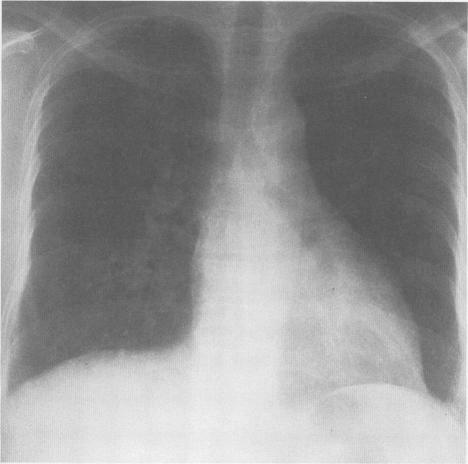 https://cdn.ncbi.nlm.nih.gov/pmc/blobs/e5f4/1022830/a6febb21de96/westjmed00058-0036-b.jpg