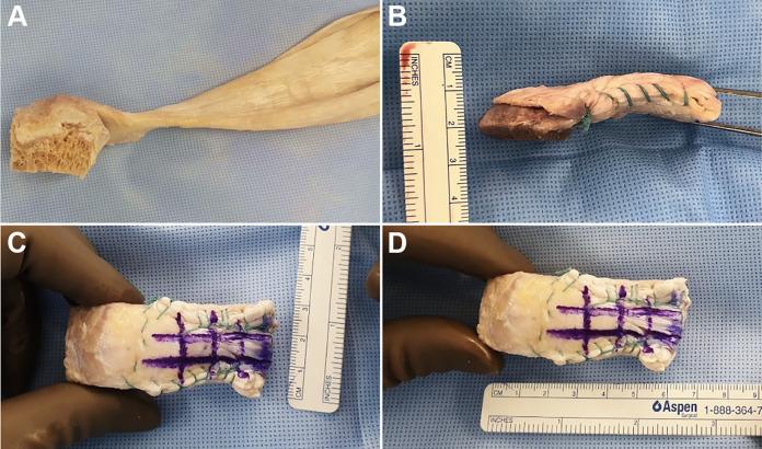 https://cdn.ncbi.nlm.nih.gov/pmc/blobs/e5f4/8113925/3b2c77892e08/10.1177_23259671211002280-fig1.jpg