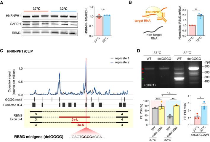 https://cdn.ncbi.nlm.nih.gov/pmc/blobs/e5f5/10350819/19a767ab40bb/EMBJ-42-e113168-g007.jpg