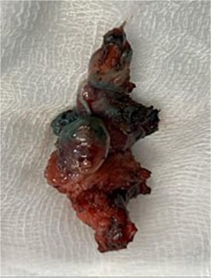 https://cdn.ncbi.nlm.nih.gov/pmc/blobs/e5f5/11967179/68ca279ac20f/rjaf172f4.jpg