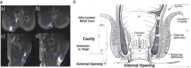 https://cdn.ncbi.nlm.nih.gov/pmc/blobs/e5f5/11967179/b9a0f15c18fd/rjaf172f2.jpg