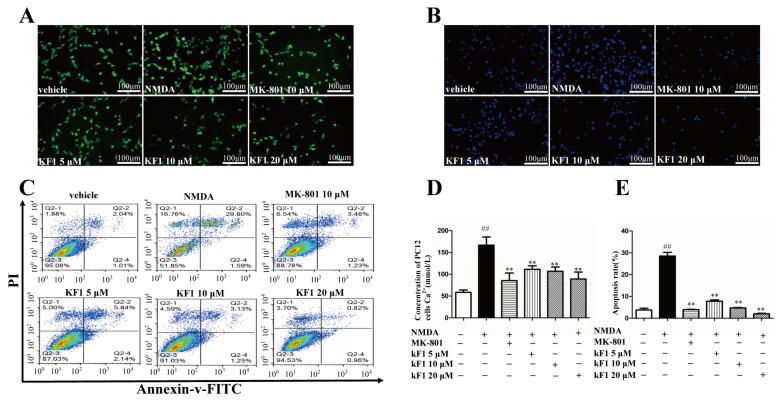 https://cdn.ncbi.nlm.nih.gov/pmc/blobs/e5fc/9785992/6572d3c0d73b/ijms-23-16150-g002.jpg